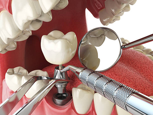 Best Emergency Treatment for Jaw Pain or Injury in Esparto, CA